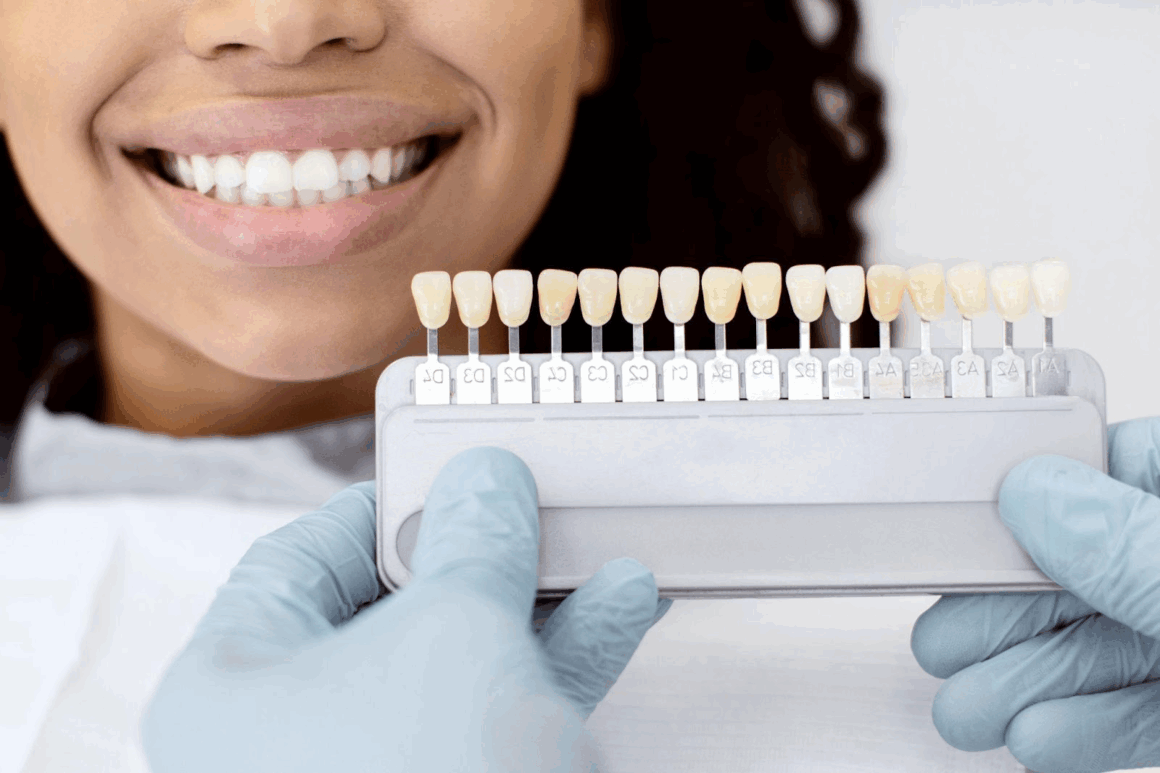Patient smiling during cosmetic dentistry consultation with dentist holding teeth shade guide for veneers and professional teeth whitening in Bradenton.